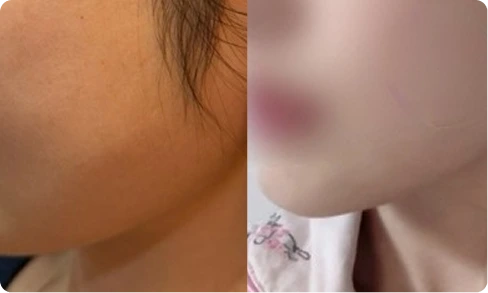 Super kind and clear support, even for first-timers.