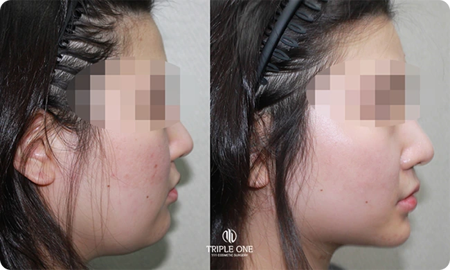 Everything was easy—even though it was my first time.